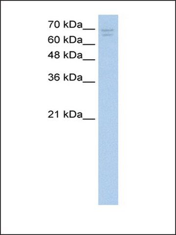 Anti-CACNB2 (ab2) antibody produced in rabbit