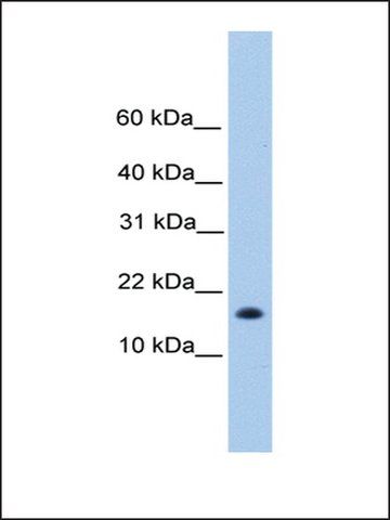 Anti-C6ORF173 antibody produced in rabbit