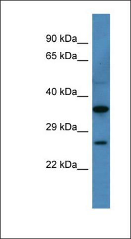 Anti-CACNG1 antibody produced in rabbit