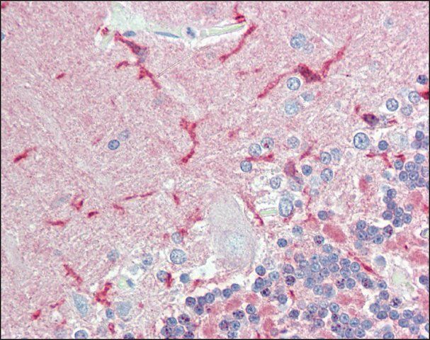Anti-CADM2 antibody produced in rabbit