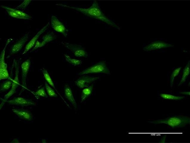 Anti-CACNB3 antibody produced in rabbit