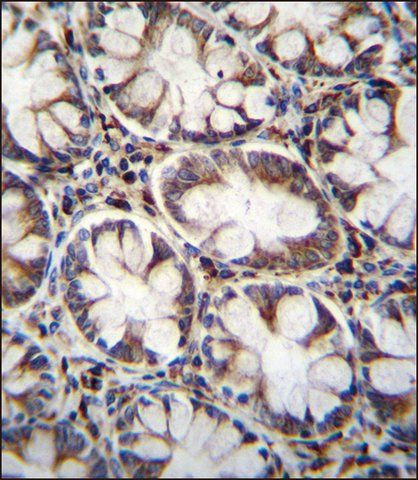 ANTI-CACNG8 (N-TERM) antibody produced in rabbit