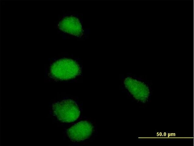 Anti-CCNE1 antibody produced in mouse