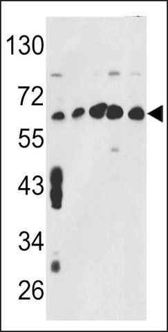 ANTI-CCT3 (CENTER) antibody produced in rabbit
