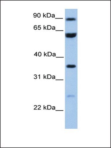 Anti-CCDC7 antibody produced in rabbit