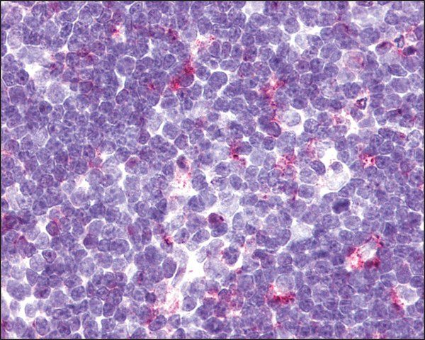 Anti-CCR9 antibody produced in rabbit