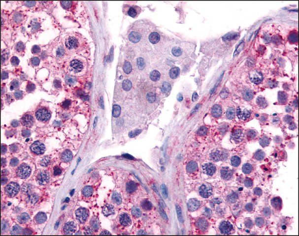 Anti-CDC7 antibody produced in rabbit