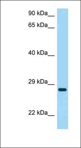 Anti-CD37 antibody produced in rabbit
