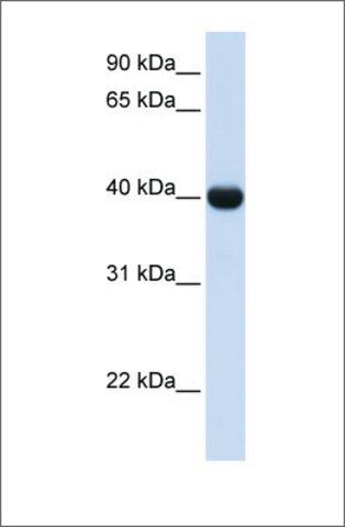 Anti-ADH1A (ab2) antibody produced in rabbit