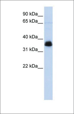 Anti-AIP antibody produced in rabbit