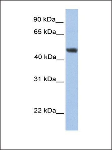 Anti-ALG2 antibody produced in rabbit