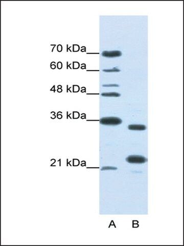 Anti-ALKBH8 antibody produced in rabbit