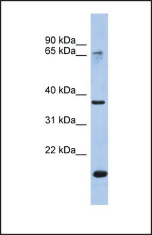 Anti-ANXA10 antibody produced in rabbit
