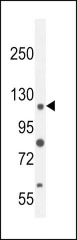 ANTI-ANR52 (N-TERM) antibody produced in rabbit