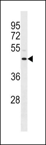 ANTI-ANXA8L1/ANXA8L2(N-TERMINAL) antibody produced in rabbit