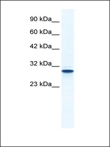 Anti-ANXA5 (AB1) antibody produced in rabbit