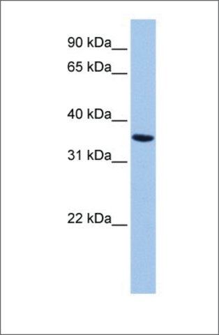 Anti-ANXA8L2 antibody produced in rabbit