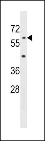 ANTI-AOAH (CENTER) antibody produced in rabbit