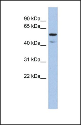 Anti-ATE1, (N-terminal) antibody produced in rabbit