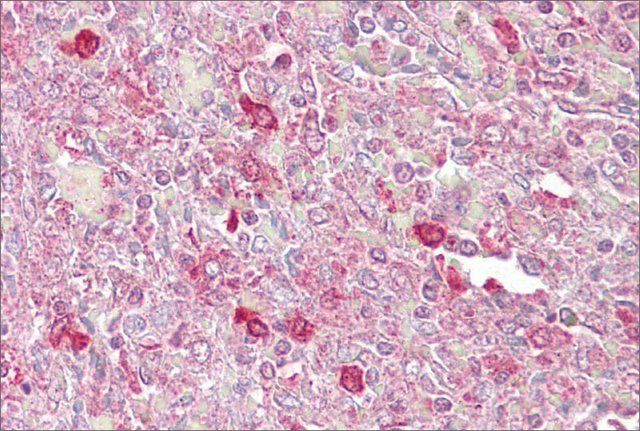 Anti-ATF1 (AB3) antibody produced in rabbit