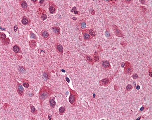 Anti-Atg12 antibody produced in rabbit