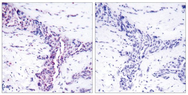 Anti-ATF2 antibody produced in rabbit