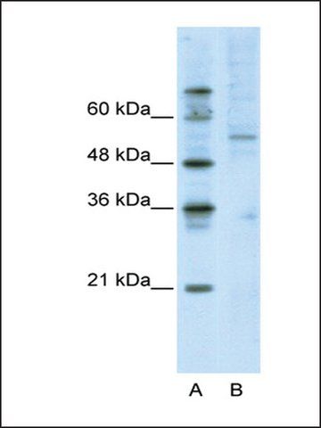Anti-ATF7 antibody produced in rabbit