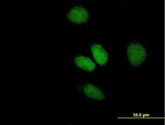 Anti-ATF2 antibody produced in mouse