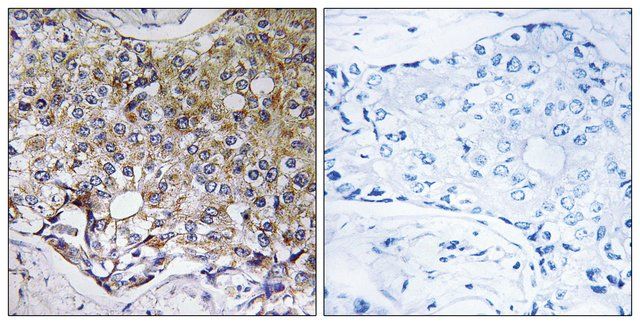 Anti-ATG4A antibody produced in rabbit
