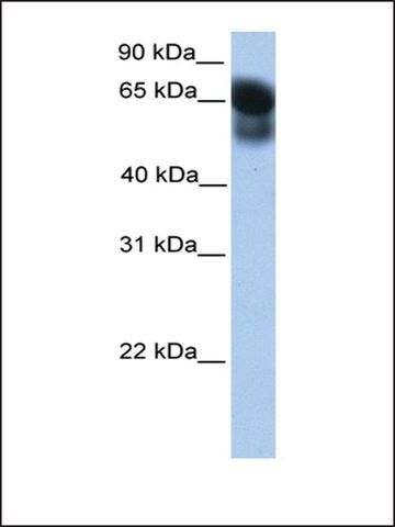Anti-ATG16L1
