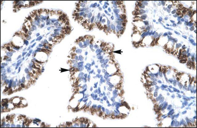 Anti-ATF2 antibody produced in rabbit