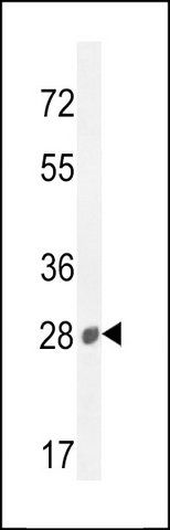 ANTI-B3GAT2 (CENTER) antibody produced in rabbit
