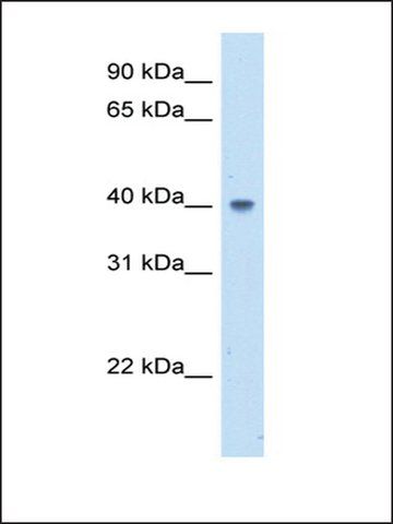 Anti-ABHD5 (AB2) antibody produced in rabbit