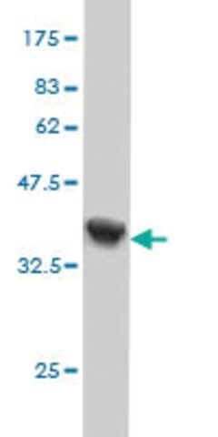 Monoclonal Anti-HNMT antibody produced in mouse