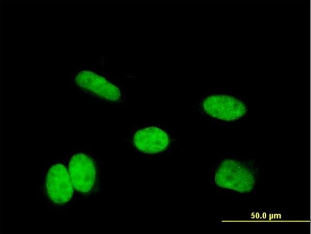 Monoclonal Anti-HOXA11 antibody produced in mouse