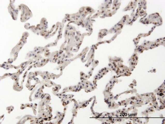 Monoclonal Anti-HMG2L1, (N-terminal) antibody produced in mouse