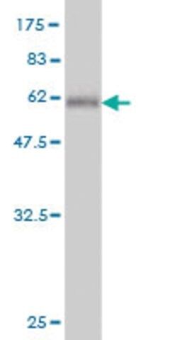 Monoclonal Anti-HOXC9 antibody produced in mouse