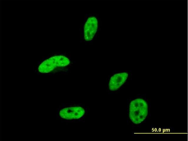Monoclonal Anti-HOXA9 antibody produced in mouse