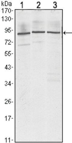 Monoclonal Anti-IGF2BP3 antibody produced in mouse