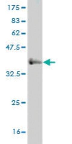 Monoclonal Anti-IL6ST antibody produced in mouse