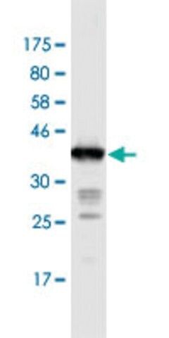 Monoclonal Anti-IL31RA antibody produced in mouse