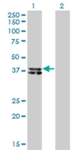 Monoclonal Anti-B4GALT4 antibody produced in mouse