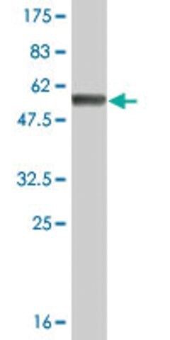 Monoclonal Anti-FBXO6 antibody produced in mouse