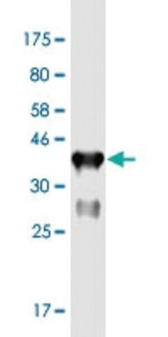 Monoclonal Anti-FBXO43 antibody produced in mouse