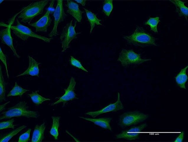 Monoclonal Anti-FPRL1 antibody produced in mouse