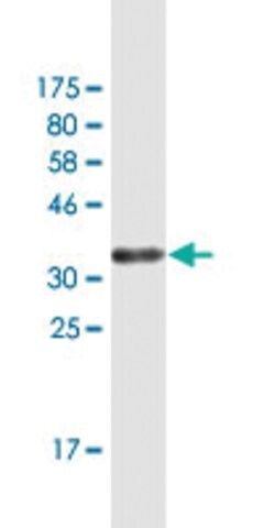 Monoclonal Anti-GLIPR1 antibody produced in mouse