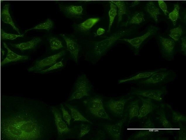 Monoclonal Anti-GFRA1 antibody produced in mouse