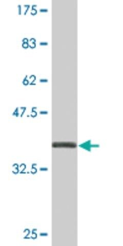 Monoclonal Anti-GIOT-1 antibody produced in mouse