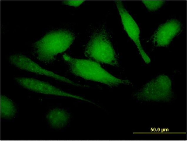 Monoclonal Anti-HBXIP, (C-terminal) antibody produced in mouse