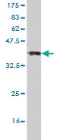 Monoclonal Anti-HIPK2 antibody produced in mouse